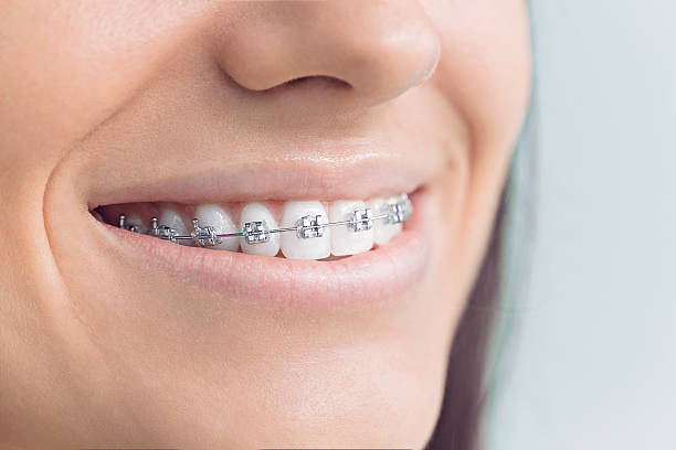 Why Choose Us for Your Dental Needs in Barnhart, MO